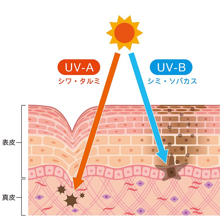 生活紫外線=UV-A